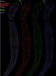 41970002 - UNC84A