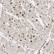 NBP1-87395 - UNC84A