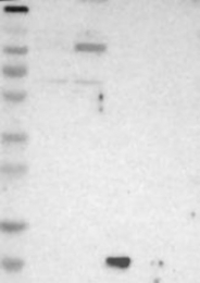 NBP1-87395 - UNC84A