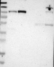 NBP1-87396 - UNC84A