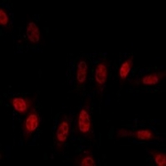 NBP1-28852 - SARS M