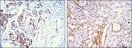 NBP1-28852 - SARS M