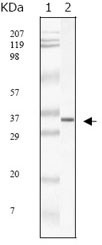 NBP1-28852 - SARS M