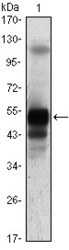 NBP1-28852 - SARS M