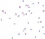 NBP1-77179 - ZFHX1B
