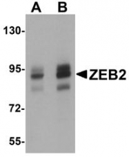 NBP1-77179 - ZFHX1B