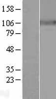 NBL1-07809 - Sodium Potassium ATPase Alpha 3 Lysate