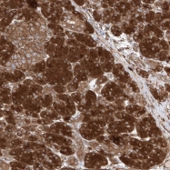 NBP1-87439 - YKT6