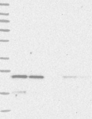 NBP1-87439 - YKT6