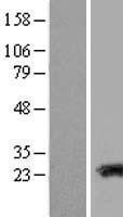 NBL1-16694 - TAGLN3 Lysate