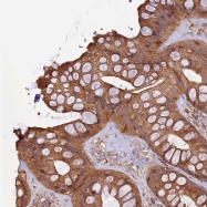 NBP1-92484 - Transcobalamin-1 (TCN1)