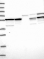NBP1-92484 - Transcobalamin-1 (TCN1)