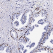 NBP1-84317 - Transcobalamin-2 (TCN2)