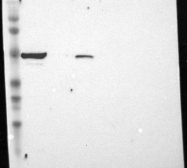 NBP1-84317 - Transcobalamin-2 (TCN2)