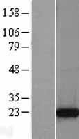 NBL1-17234 - TCTP Lysate