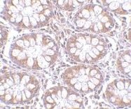 NBP1-77310 - CD248 / TEM1