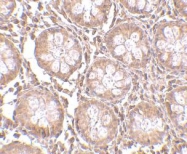 NBP1-77311 - CD248 / TEM1