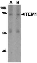 NBP1-77311 - CD248 / TEM1