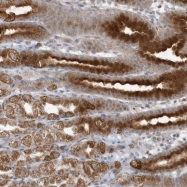 NBP1-82315 - THG1L / ICF45