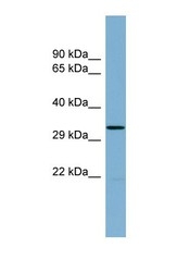 NBP1-56583 - THG1L / ICF45