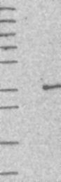 NBP1-82315 - THG1L / ICF45