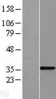 NBL1-16958 - TLX3 Lysate