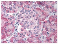 NBP1-44369 - TM9SF4