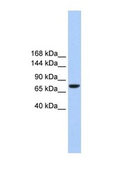 NBP1-59417 - TMC2