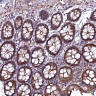 NBP1-83696 - TMC5