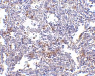 NBP1-76892 - TMC6 / EVER1