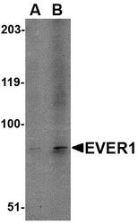 NBP1-76891 - TMC6 / EVER1