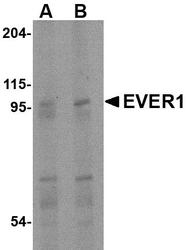 NBP1-76892 - TMC6 / EVER1