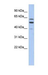 NBP1-59917 - TMCC1