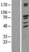 NBL1-16975 - TMCC1 Lysate
