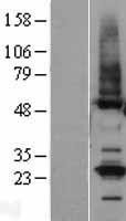 NBL1-16976 - TMCO1 Lysate
