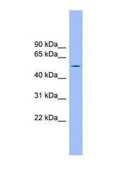 NBP1-57660 - TMCO6