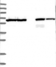NBP1-83463 - TMCO6