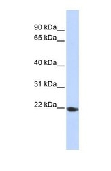 NBP1-62557 - TMED1