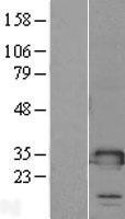 NBL1-16979 - TMED1 Lysate