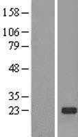 NBL1-16981 - TMED2 Lysate