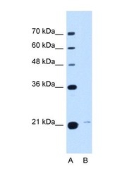 NBP1-69575 - TMED3