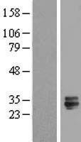NBL1-16984 - TMED6 Lysate