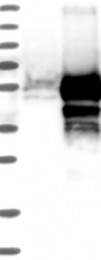 NBP1-84744 - TMED8 / FAM15B