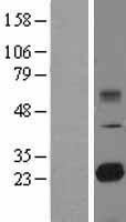 NBL1-16986 - TMED9 Lysate
