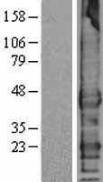 NBL1-16987 - TMEFF1 Lysate