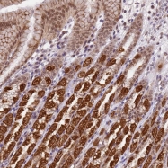 NBP1-92515 - TMEM104