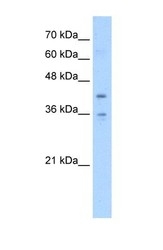 NBP1-59389 - TMEM104