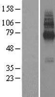NBL1-16993 - TMEM104 Lysate