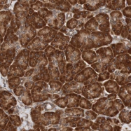 NBP1-93462 - TMEM109