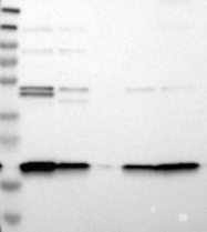 NBP1-93462 - TMEM109